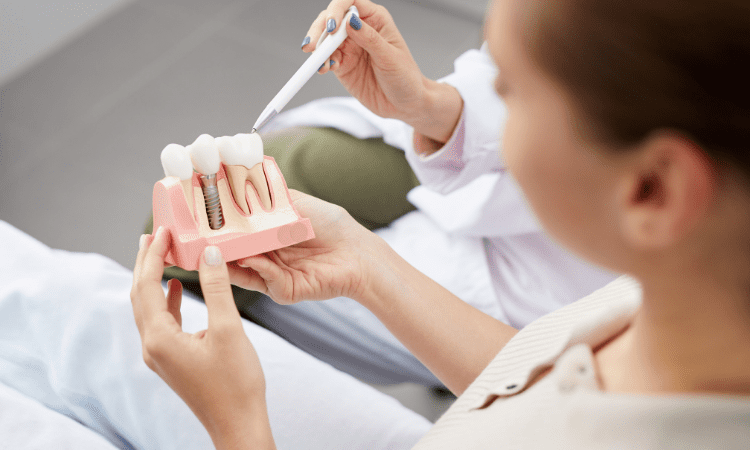 If you have insufficient jawbone density, a bone graft comes in as a preparatory step that can be crucial for implant success.